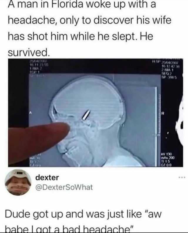 A man in Florida woke up with a headache only to discover his wife has shot him while he slept. He survived. 1MA 2 dexter @DexterSoWhat babe laot a bad headache 124W TI15 Dude got up and was just like aw GTO0