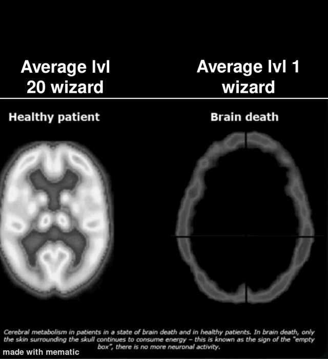Average Ivl 1 Average lvl 20 wizard wizard Healthy patient Brain death Cerebral metabolism in patients in a state of brain death and in healthy patients. In brain death only the skin surrounding the skull continues to consume ener