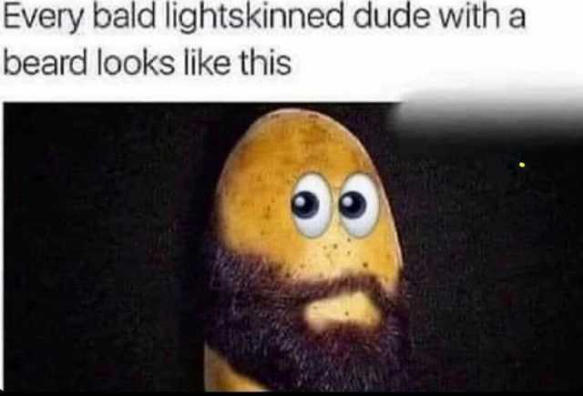 Every bald lightskinned dude with a beard looks like this