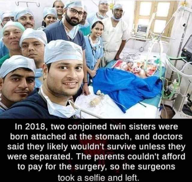 In 2018 two conjoined twin sisters were born attached at the stomach and doctors said they likely wouldnt survive unless they were separated. The parents couldnt afford to pay for the surgery so the surgeons took a selfie and left