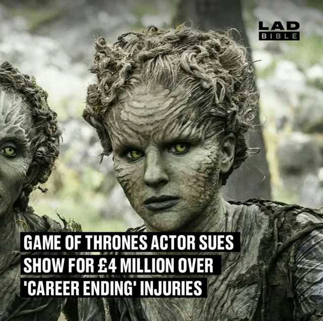 LAD BIBLE GAME OF THRONES ACTOR SUES SHOW FOR £4 MILLION OVER CAREER ENDING INJURIES
