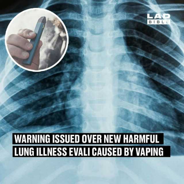 LAD BIBLE WARNING ISSUED OVER NEW HARMFUL LUNG ILLNESS EVALI CAUSED BY VAPING