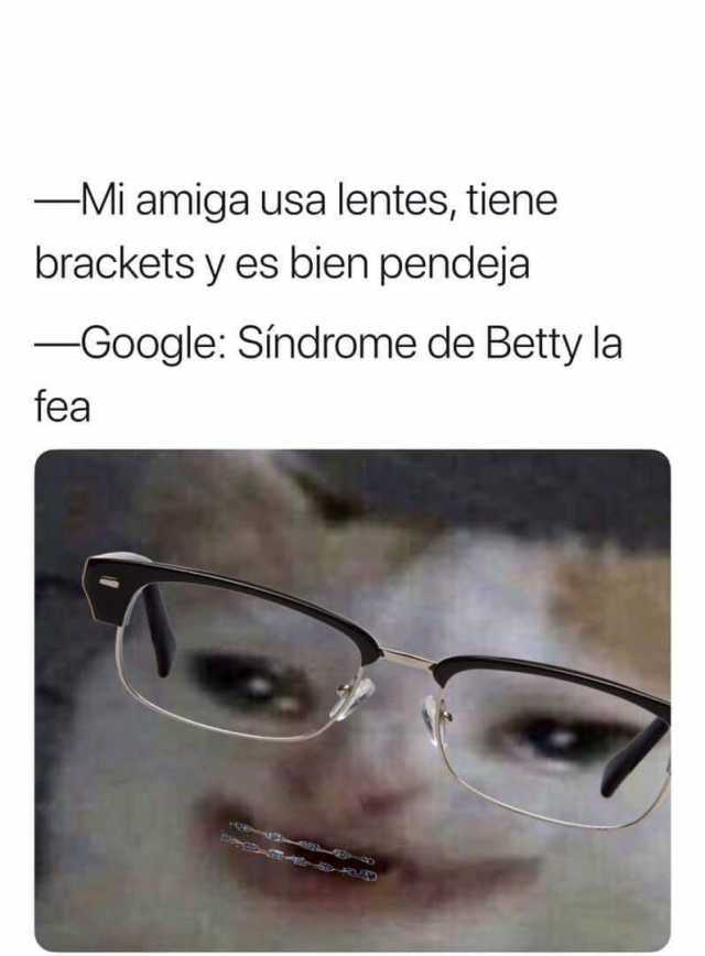 -Mi amiga usa lentes tiene brackets y es bien pendeja -Google Sindrome de Betty la fea 