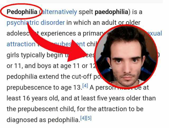 Pedophilia alternatively spelt paedophilia) is a psychiatric disorder in which an adult or.older adolesc experiences a primary xual attraction ubesent chi girls typically begin w Ces or 11 and boys at age 11 or 12 pedophilia exten
