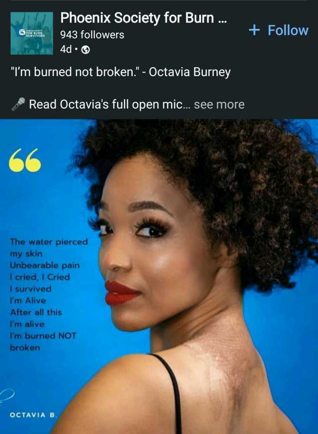Phoenix Society for Burn. E 943 followers +FollowN 4d Tm burned not broken. - Octavia Burney Read Octavias full open mic... see more The water pierced my skin Unbearable pain I cried I Cried I survived Im Alive After all this Im a