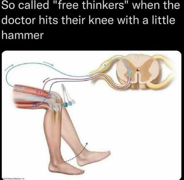 So called free thinkers when the doctor hits their knee with a little hammer