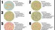 Colour Blindness Eye Exam Developed by the national association of optometrists and neurological experts 2 Blue/Orange Green/Red Failure to distinguish the number may mean extreme stress or Faure oer may mean a mutation in the Y t