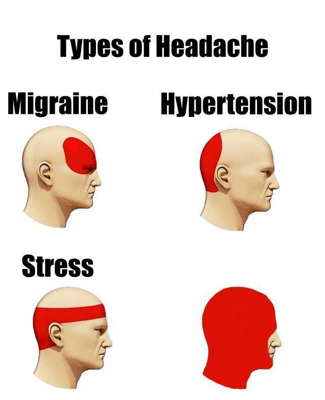 Types of headache original template for making memes