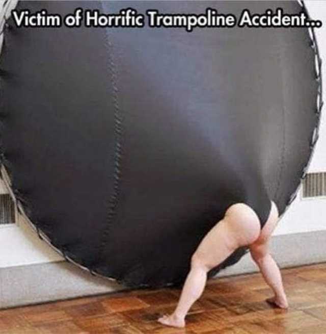 Victim of Horrific Trampoline Accident 