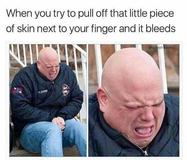 When you try to pull off that little piece of skin next to your finger and it bleeds @sideofrcepilaf